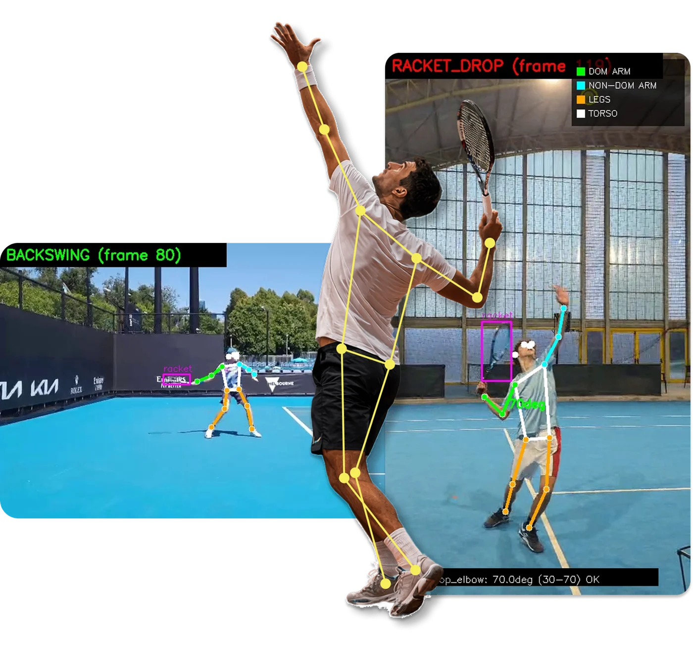 TennisIA analysis of serves and forehands with body landmark tracking